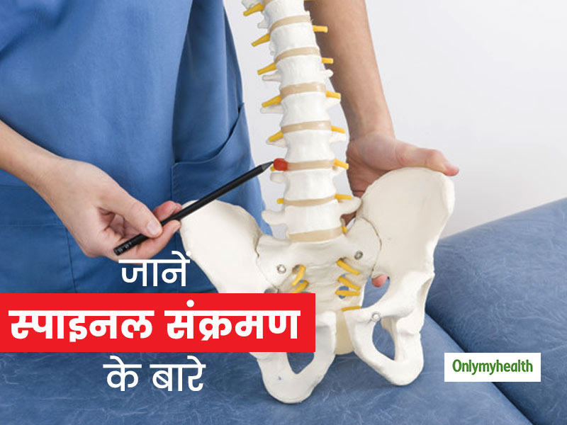 रीढ़ के आकार को बिगाड़ सकता है स्पाइनल संक्रमण, एक्सपर्ट से जानें लक्षण और उपचार